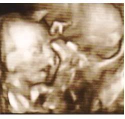 3-d at 19 weeks