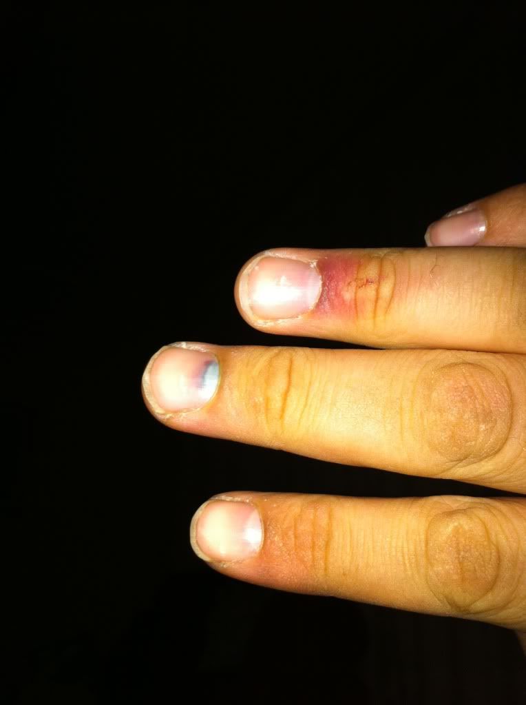 e28finger.jpg