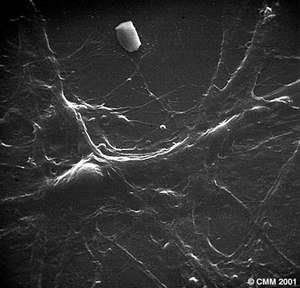 Neurons (Microscopy)