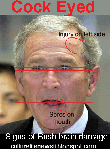 Culture Of Life Health News Bush Is Cockeyed Drunk