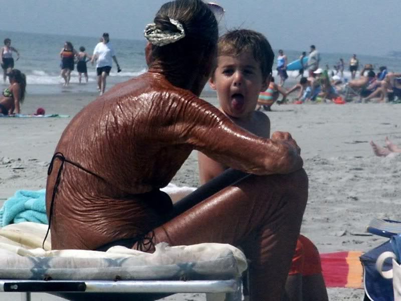 https://i3.photobucket.com/albums/y76/unnamednewbie13/sunburn.jpg